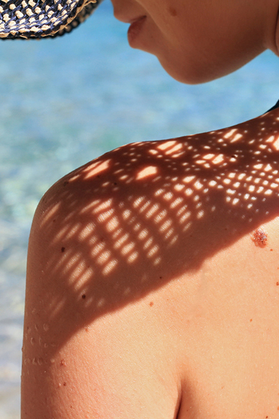 Préservez votre peau au soleil afin d'éviter les mélanomes